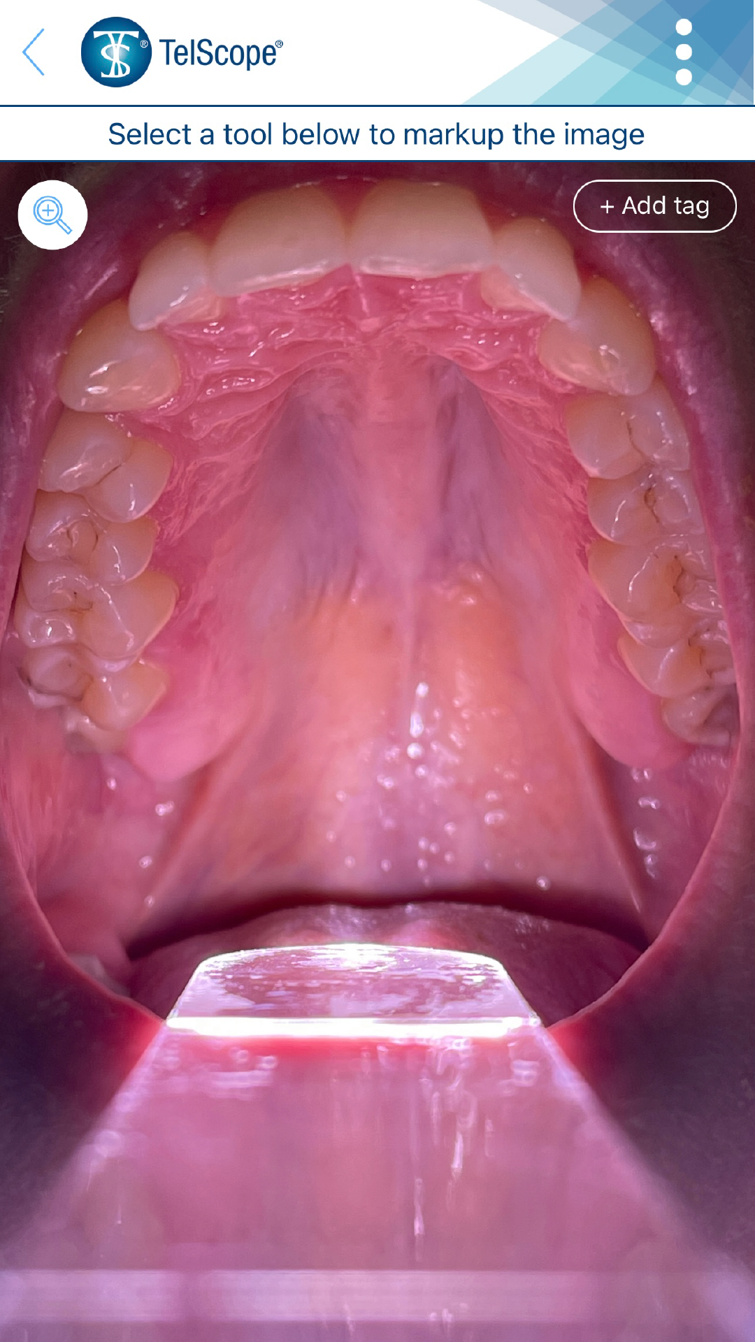 Interoral camera with light